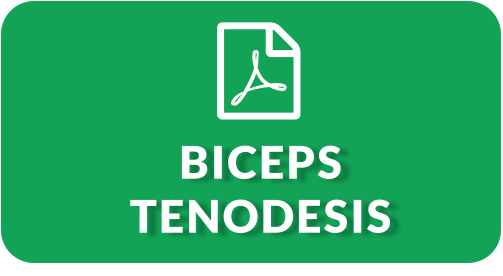 BICEPS TENODESIS