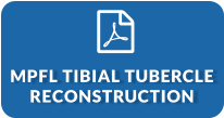 MPFL Tibial Tubercle Reconstruction (PDF)